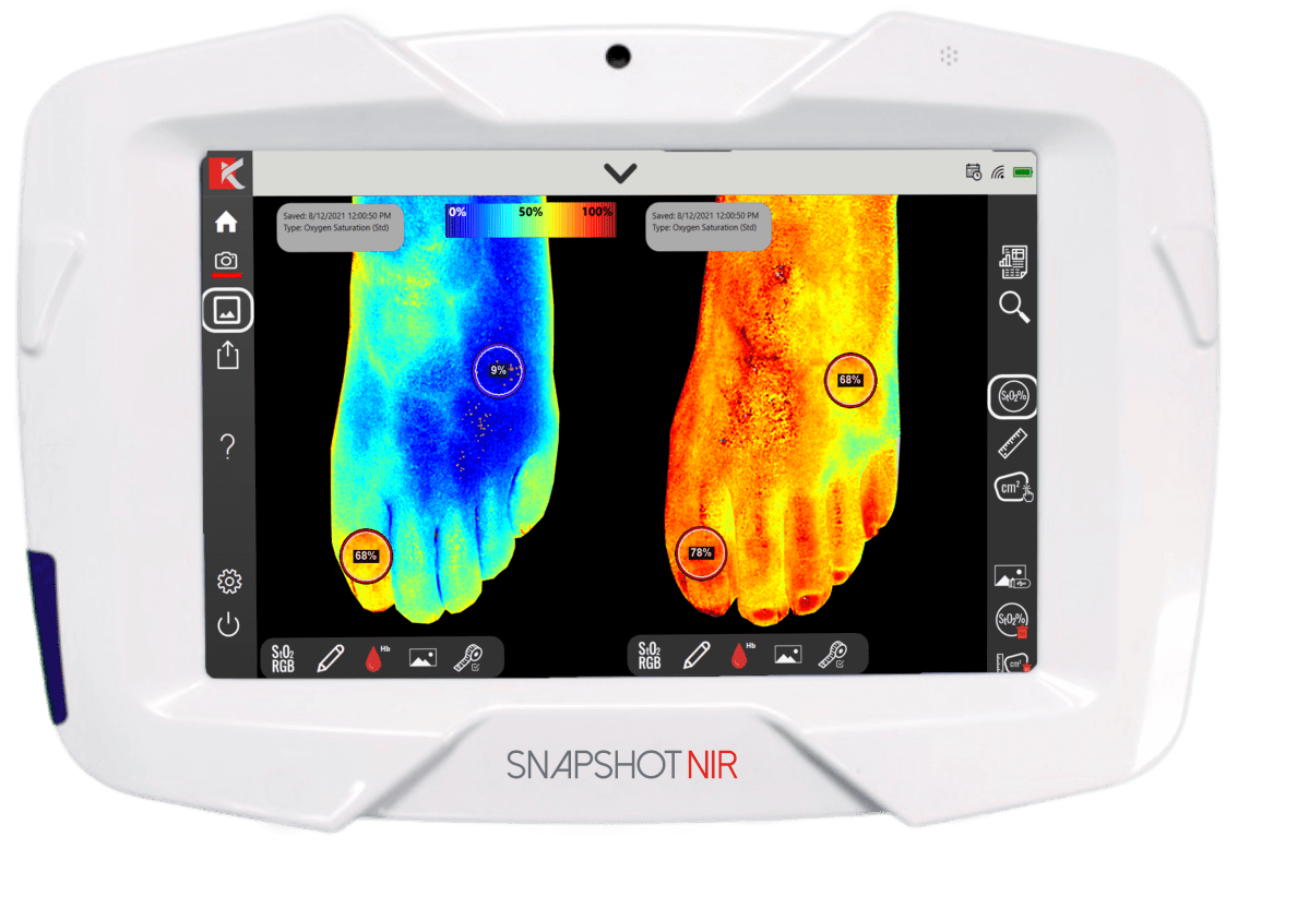 The device is changing wound healing.