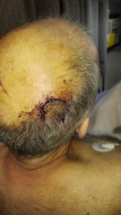 Man stabbed in attack in Edmonton on May 5, 2024.