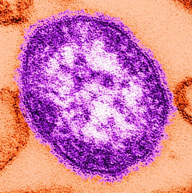 This undated image made available by the Centers for Disease Control and Prevention on Feb. 4, 2015, shows an electron microscope image of a measles virus particle. New Brunswick health officials have announced an end to the measles outbreak in Fredericton and the upper Saint John River valley. THE CANADIAN PRESS/AP-Cynthia Goldsmith/Centers for Disease Control and Prevention via AP, File.