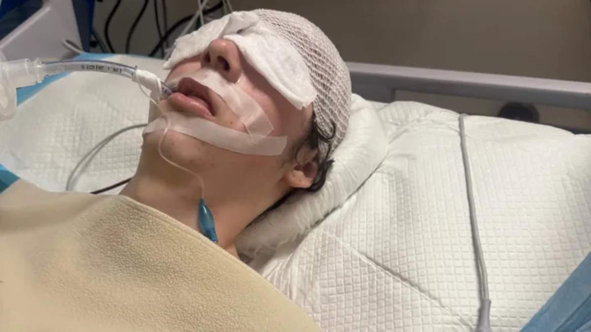 Chase Delorme-Rowan, 18, in a medically-induced coma in Dominican Republic after suffering injuries at a resort on the Caribbean island in January 2025.