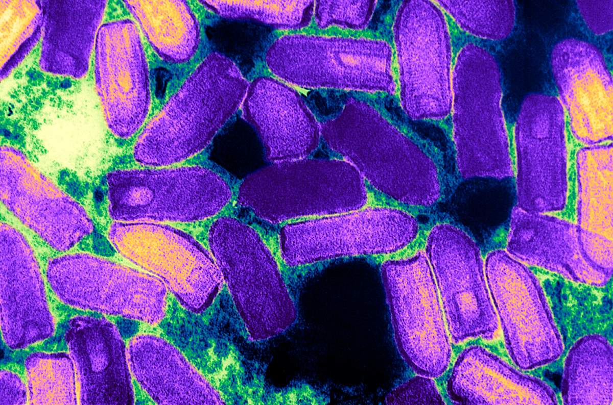 Causal Agent Of Vesicular Stomatitis In Cattle, Horses And Pigs. This Electron Micrograph Depicts The Vesiculovirus Responsible For Vesicular Stomatitis Vs In Horses, Cattle And Pigs. As A Member Of The Rhabdoviridae Family Of Viruses, YouLl Note The Morphologic Similarity, I. E. , Bullet Shaped Virion, Between This Vesicular Stomatitis Virus Vsv, And The Rabies Virus. (Photo By BSIP/UIG Via Getty Images)