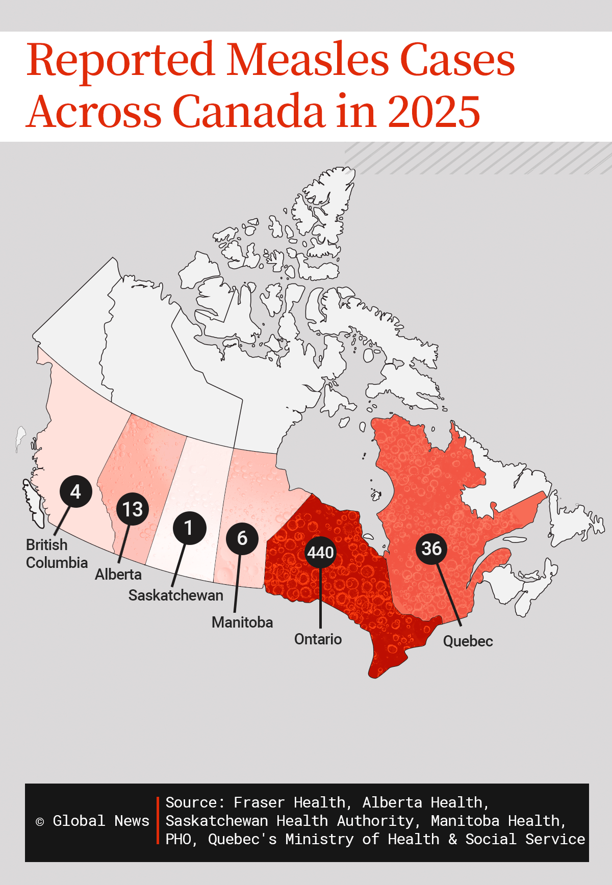 Measles is spreading across Canada. A look at the affected areas - image