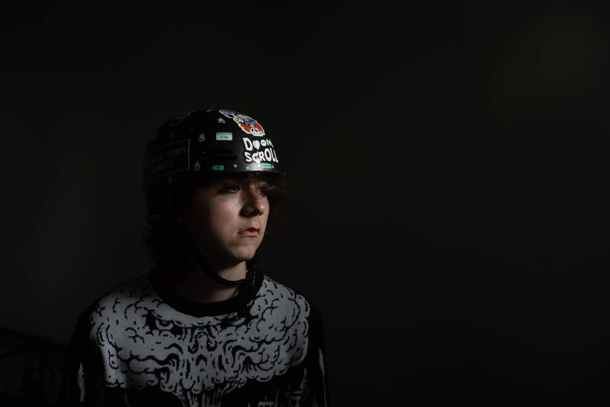 Chase Delorme-Rowan in Edmonton, Wednesday, April 2, 2025. While Delorme-Rowan waits for the surgery to replace a piece of his missing skull, cracked in an assault while on vacation with family in the Dominican Republic, he has to wear a helmet to protect his brain whenever he stands up or moves.