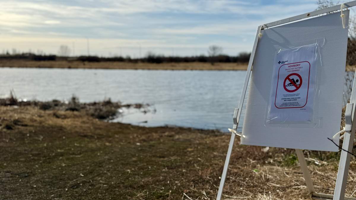 A water quality advisory sign warning of fecal bacteria in the Sturgeon River in St. Albert, Alta. on Friday, April 18, 2025.