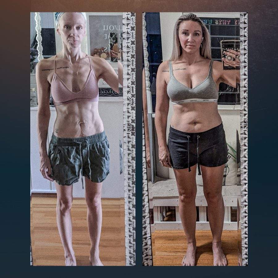 Photos of Becky Marie Campbell while sick and healthy
