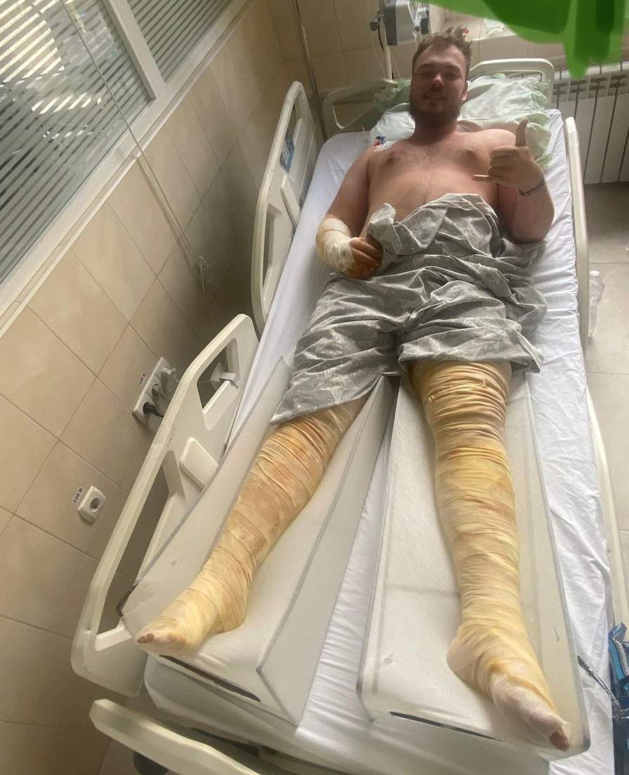 22-year-old MacKenzie Hughes, from Calgary, is seen in a hospital in Kyiv, Ukraine after he was injured in a Russian attack on July 1, 2025.