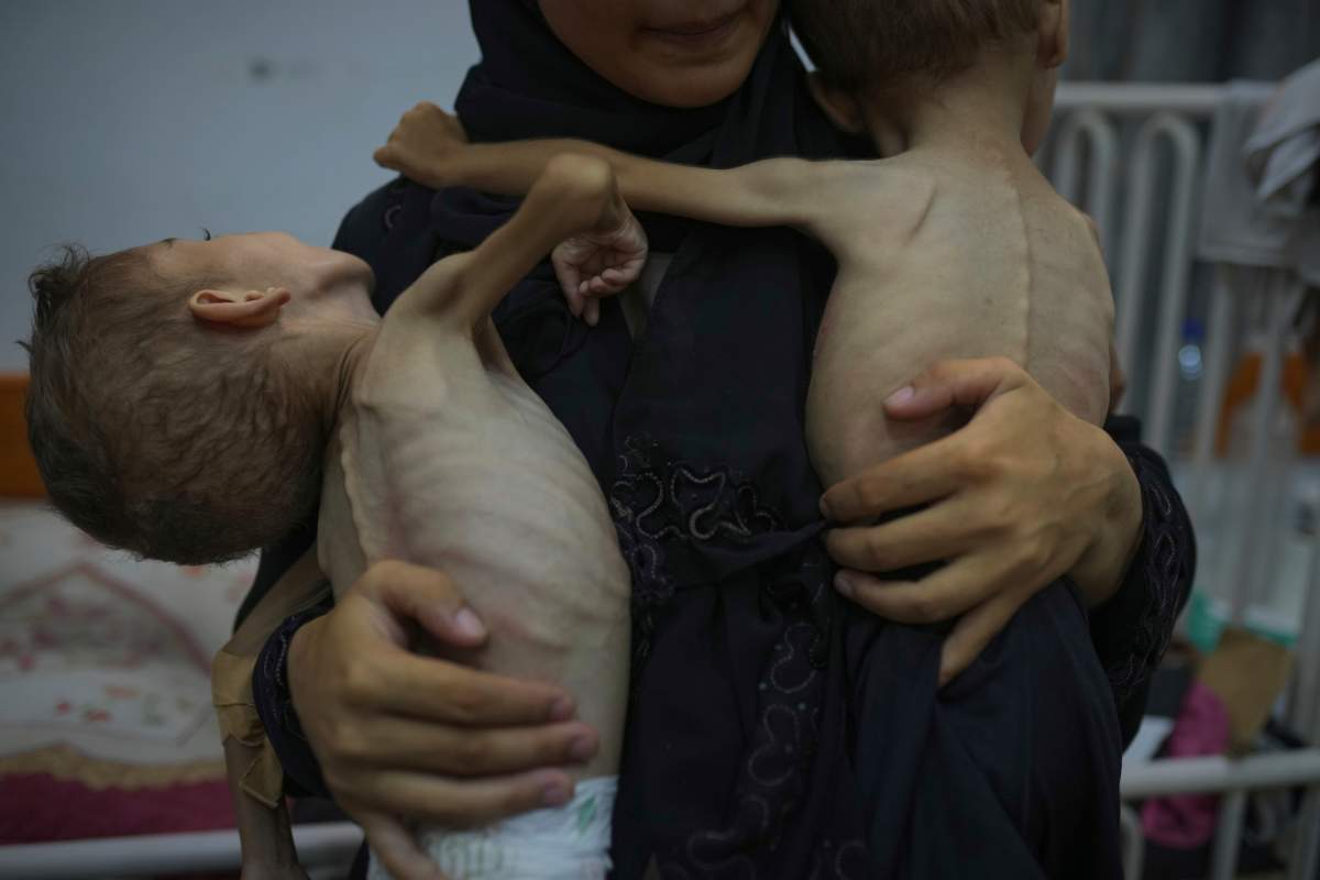 Omniya Mahra, holds shirtless for a photo her sons Oday, 4, left, and Mohammed, 3, who suffer from malnutrition and a genetic nerve disorder, at the Friends of the Patient Hospital in Gaza City, Tuesday, July 29, 2025.