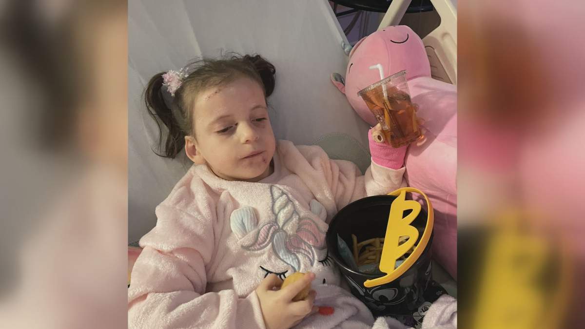 Camila Hallett, 5, is pictured in hospital. She was attacked by dogs on Oct. 14.