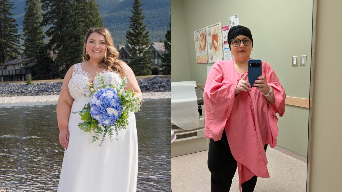 Amanda Purcell was diagnosed with Stage 2 triple negative breast cancer just three weeks before her wedding in spring of 2025 and afterwards started 21 weeks of chemotherapy.