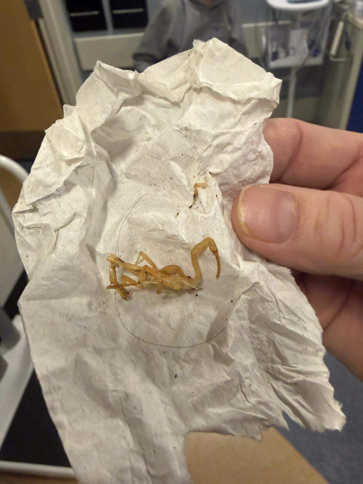 The dead scorpion after biting Luke Susi.