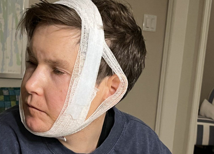 Chris Beddoe is shown in this undated handout photo after he was "savagely bitten" on the neck by another resident of an Ontario group home for adults with disabilities in December 2025.