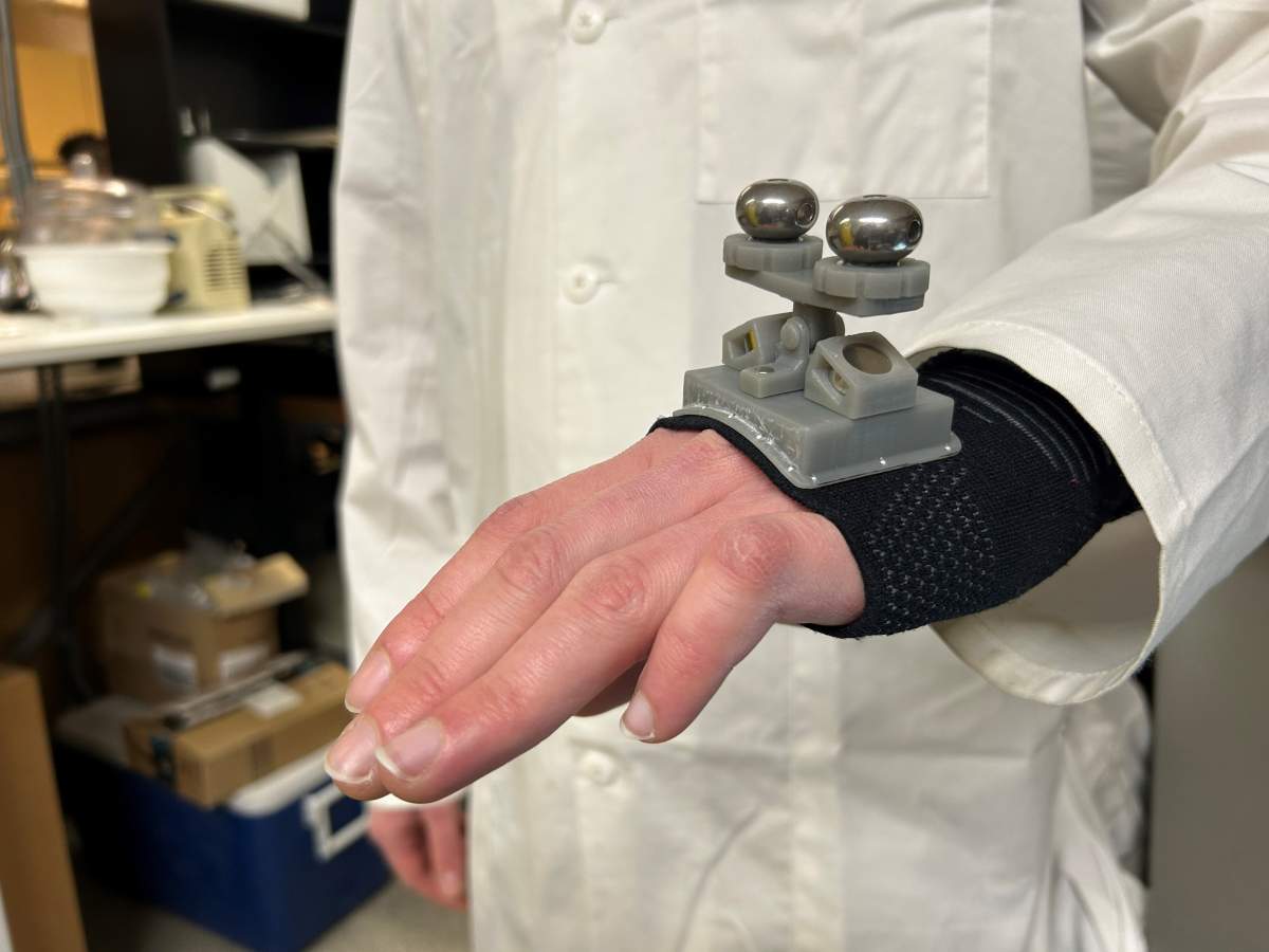 One of the versions of the tremor-reducing hand brace as researchers work towards final development of the device.