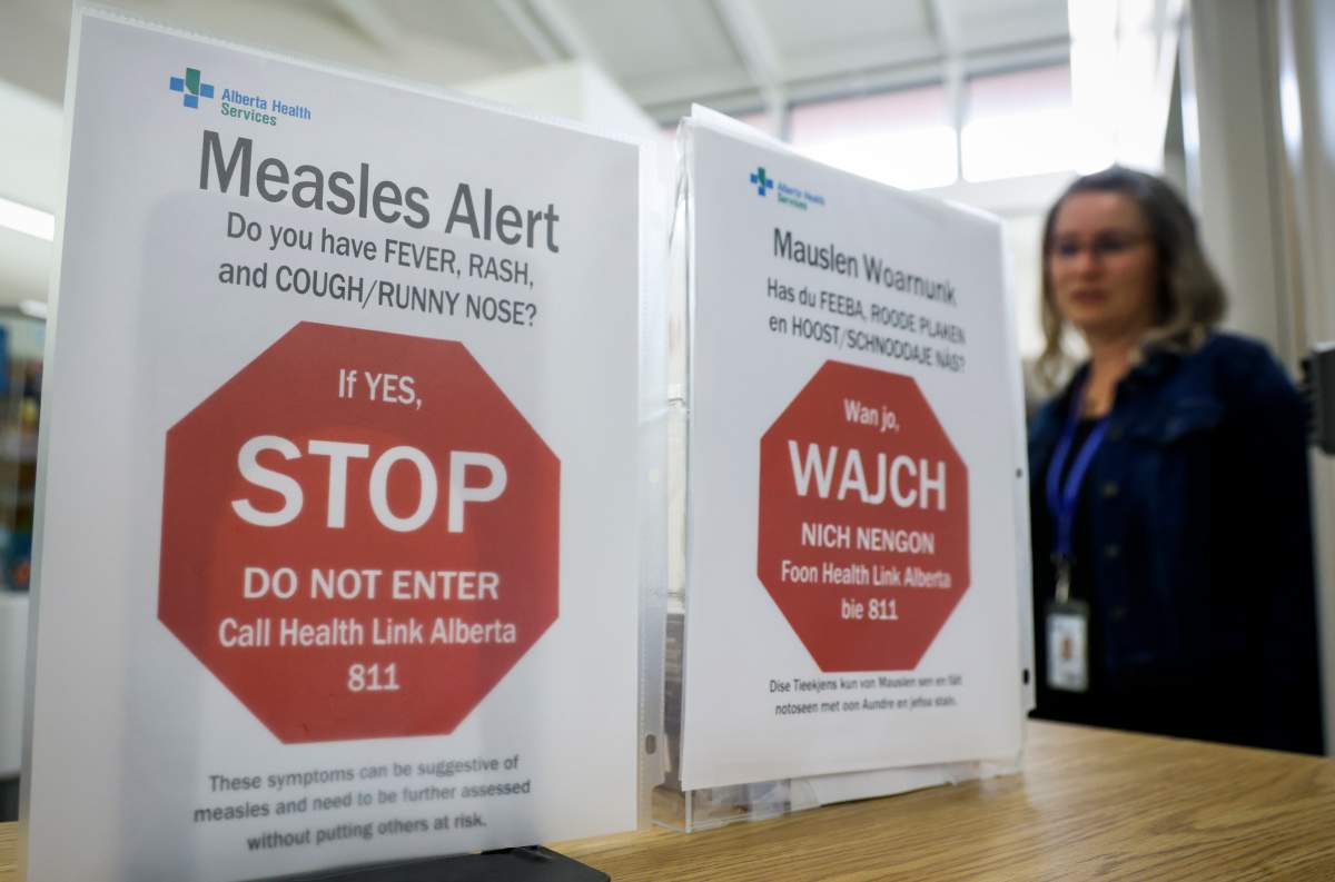 Measles sign