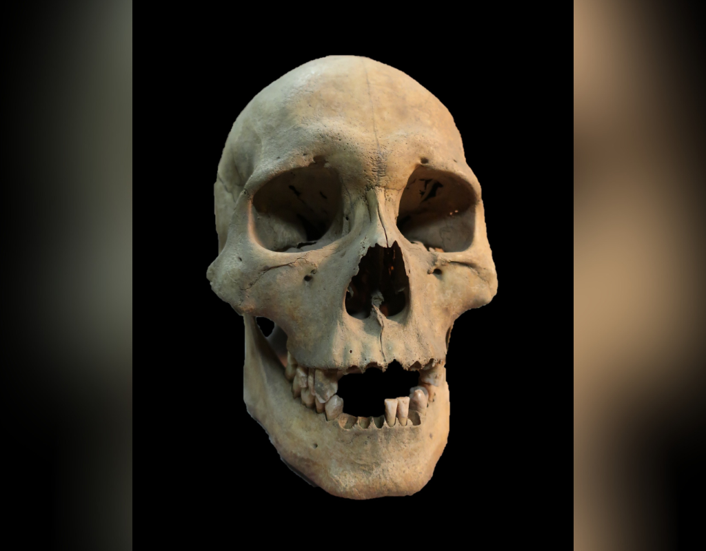 This 2019 image from Angela Lieverse shows the skull of an adult woman who was infected with the plague and was buried in Siberia.