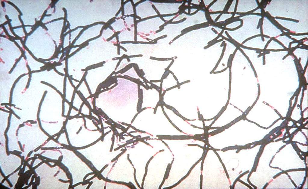 A microscopic view of the anthrax bacteria in an undated photo from the Command at Fort Detrick, Md.